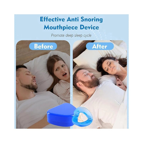 Anti snore mouthpiece from multiple angles